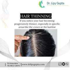One of the key signs is progressive hair thinning, especially around the crown or a receding hairline. If you notice your part widening or less volume overall, PRP can help improve hair thickness and density.