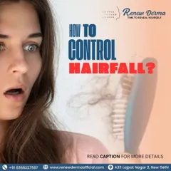 Wondering how to control hair fall? PRP therapy is a powerful solution. This treatment uses the concentrated platelets from your own blood to stimulate the scalp, improve circulation, and activate hair growth.