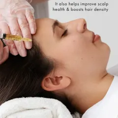 During a PRP session, the concentrated plasma is carefully injected along the hairline and areas of thinning. This process improves blood flow, nourishes the scalp at a cellular level, and boosts overall hair density for a healthier appearance.