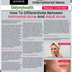 I was featured in Onlymyhealth to discuss the key differences between hormonal acne and adult acne. While they can look similar, understanding the triggers, such as hormonal fluctuations versus lifestyle factors, is essential for effective and long-lasting treatment.