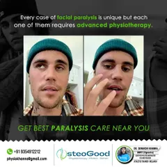 Facial paralysis, or Bell's Palsy, requires a very specific and gentle approach. I use advanced physiotherapy techniques to help patients regain facial muscle control, improve symmetry, and restore their confidence.