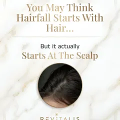 Many believe hair fall is a hair problem, but it's a scalp problem. An unhealthy scalp environment with clogged follicles or inflammation cannot support strong hair growth. A proper diagnosis always begins with a close look at the scalp.