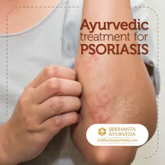 Psoriasis requires a deep, internal approach. This image represents the start of a healing journey for those suffering from itchy, inflamed skin, for whom I provide a comprehensive treatment plan.