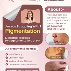 Are you struggling with pigmentation issues like melasma, freckles, or hyperpigmentation? This graphic shows the different types of concerns we treat with solutions like laser therapy, chemical peels, and medical-grade skincare.