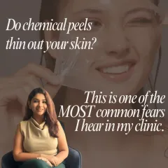 One of the most common fears I hear in my clinic is that chemical peels thin out the skin. This is a myth. When performed correctly by a professional, peels actually stimulate collagen and thicken the dermis over time.