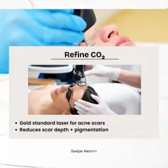 Refine CO₂ is the gold standard laser for treating deep acne scars. It works by resurfacing the skin to reduce scar depth and associated pigmentation for a smoother texture.