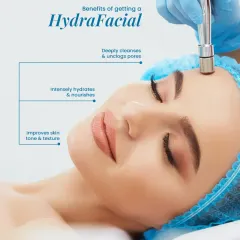 This image illustrates the key benefits of a HydraFacial treatment. This medical-grade facial provides deep cleansing to unclog pores, intense hydration for a nourished feel, and gentle exfoliation to improve overall skin tone and texture.