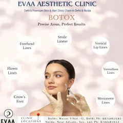 We use Botox to target precise areas for perfect results. This diagram illustrates the various facial lines we can treat, including forehead lines, crow's feet, and smile lines.