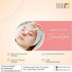 Chemical peels are a powerful tool for skin renewal. This graphic outlines the key benefits, including erasing fine lines, treating sun damage, fading hyperpigmentation, and preventing acne breakouts for clearer, younger-looking skin.