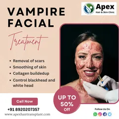 Our Vampire Facial is not just for anti-aging; it is also a highly effective treatment for acne scars and controlling blackheads. By promoting collagen buildup and skin renewal, this procedure helps to smooth out skin texture left behind by previous breakouts.