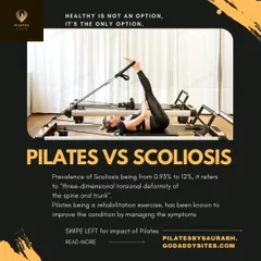 Pilates is a powerful rehabilitation exercise for managing the symptoms of scoliosis. This graphic introduces the condition, which is a three-dimensional deformity of the spine.