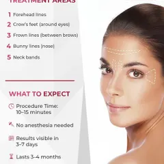 This visual guide shows the common areas I treat with Botox, including forehead lines, crow's feet, and frown lines. The procedure itself is very quick, typically 10-15 minutes, with results becoming visible in 3-7 days and lasting for 3-4 months.