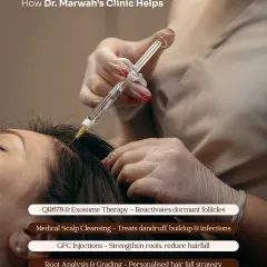 Here, a patient is undergoing a targeted GFC (Growth Factor Concentrate) injection. This procedure delivers a high concentration of growth factors directly to the scalp, strengthening hair roots and reducing hair fall with clinical precision.