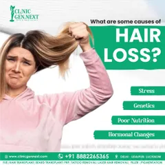 Hair loss in women can be caused by several factors. This visual points to common triggers like stress, genetics, poor nutrition, and hormonal changes, which can occur during different life stages.
