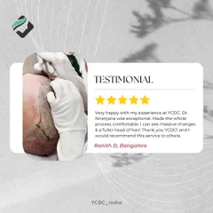 This patient describes his experience as "exceptional" and the process as "comfortable." Seeing massive changes and a fuller head of hair is the goal I strive for with every patient.