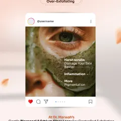 Habit 2: Over-Exfoliating. Using harsh physical scrubs can damage your skin's protective barrier, leading to inflammation and more pigmentation. We use gentle BioRePeel and Erbium Glass Laser for controlled exfoliation that also boosts collagen.