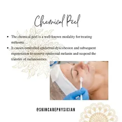 Chemical peels are a well-known and effective modality for treating melasma. They work by causing controlled exfoliation of the top layer of skin, which helps remove epidermal melanin and regenerate healthier skin.