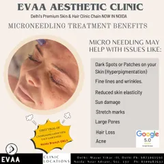 An informational graphic on the benefits of Microneedling. This versatile treatment addresses various concerns including fine lines, large pores, and hyperpigmentation, and can also be an effective therapy for certain types of hair loss.