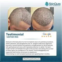 Laxman Das describes his procedure as painless, with artistic precision. He was impressed by the meticulous approach to creating a natural hairline and the knowledgeable, supportive staff that made him feel comfortable throughout his journey.