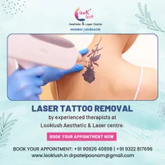 This graphic shows a laser tattoo removal treatment in progress. If you have a permanent tattoo you no longer want, my painless laser treatment can help you get rid of it.