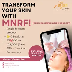 Transform your skin with Microneedling Radio Frequency (MNRF). This is one of our exclusive deals, offering significant savings on a package of 6 sessions plus a free scar treatment to enhance your results.