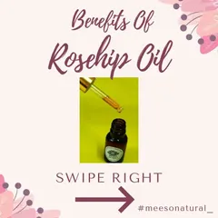 Let's talk about the benefits of Rosehip Oil. This image is the start of a series explaining why this natural oil is considered liquid gold for your skin.