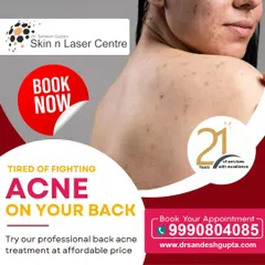 Tired of fighting acne on your back? I offer professional back acne treatments at an affordable price. With 21 years of service, my clinic is equipped to handle persistent body acne and help you achieve clear skin.