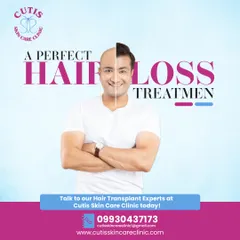 A split-image graphic demonstrating a successful hair loss treatment. The left side shows a man with noticeable hair thinning, while the right side shows him with a full, healthy head of hair, representing the perfect solution for hair restoration.