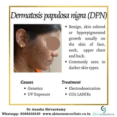 This graphic provides key information about Dermatosis Papulosa Nigra (DPN). It explains that these are benign growths common in darker skin types and outlines the effective treatment options I offer, such as electrodesiccation and CO2 lasers, for cosmetic removal.