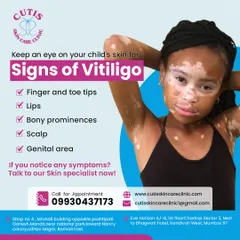It is important to keep an eye on your child's skin for early signs of vitiligo. This graphic highlights common areas where depigmented patches may appear, such as fingertips, lips, and the scalp. Early detection is key, so talk to our skin specialists if you notice any symptoms.