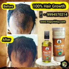 Seeing is believing. This is the result of using our Biotin Powder and Hair Growth oil. We use a powerful blend of natural seeds, herbs, and oils to tackle hair fall and stimulate new growth from the roots. This is not a quick fix, but a real, organic solution for hair concerns.