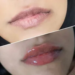 For this client, the goal was to add life and color to lips that were naturally pale and undefined. The after photo shows a beautiful coral-pink tint that brings warmth to the entire face, with a defined cupid's bow.