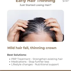 If you've just started noticing hair thinning, now is the best time to act. Early intervention with treatments like PRP, supportive medications, and lifestyle adjustments can effectively strengthen existing hair and prevent further loss.