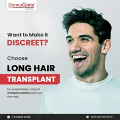 For those who want to keep their procedure private, the Long Hair Transplant is the ideal solution. It offers a seamless, natural transformation without the wait, allowing you to return to your life with confidence.
