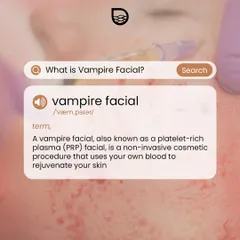 This provides a clear definition of the "Vampire Facial". It is a non-invasive cosmetic procedure where I use platelet-rich plasma derived from your own blood to stimulate skin healing, collagen production, and cellular renewal.