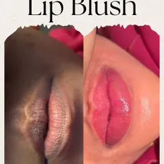 A vertical before and after of a lip blush transformation. This treatment is perfect for correcting uneven color and defining the lip shape for a fuller, more symmetrical appearance.