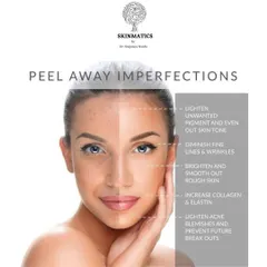Chemical peels are a versatile and effective way to address multiple skin imperfections. They can lighten pigment, diminish fine lines, smooth rough texture, and help prevent future acne breakouts.