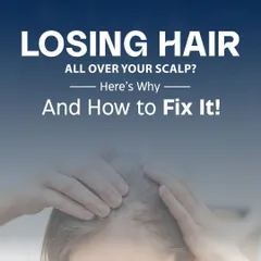Are you losing hair all over your scalp? This condition, known as diffuse hair loss or Telogen Effluvium, is often caused by triggers like stress, nutritional gaps, or poor scalp hygiene. The good news is that it is often reversible once the root cause is addressed.