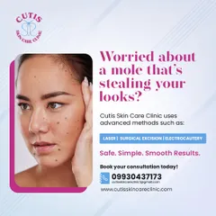 A mole shouldn't affect your confidence. We use advanced methods like laser, surgical excision, and electrocautery to provide safe, simple, and smooth results. Our expert dermatologists will recommend the best approach for your specific needs.