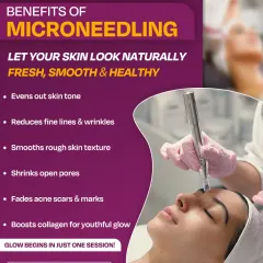 This graphic clearly outlines the multiple benefits of microneedling. It serves as a quick, informative guide for clients, covering everything from evening out skin tone and reducing wrinkles to shrinking pores and fading acne scars.