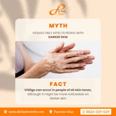 Vitiligo can occur in people of all skin tones. While the contrast may make it more noticeable on darker skin, it is a condition that affects individuals from every background.
