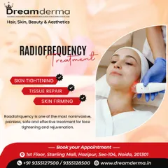 This image showcases a Radiofrequency treatment, a painless and effective method I use for skin firming and tissue repair by gently heating the skin to stimulate collagen.