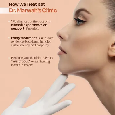 Your skin is your body's first line of defense. This graphic explains my approach to treating skin conditions: we diagnose at the root with clinical expertise, provide evidence-based treatments, and handle every case with empathy because you shouldn't have to "wait it out."