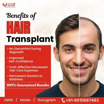 A hair transplant is more than just a procedure; it's an investment in your confidence. This graphic outlines the key benefits, including a permanent solution to baldness, no discomfort, and improved self-confidence.