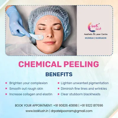 This graphic clearly lists the benefits of a chemical peel. It can brighten your complexion, smooth rough skin, increase collagen, lighten pigmentation, diminish fine lines, and clear stubborn blackheads. It is a versatile treatment for overall skin improvement.