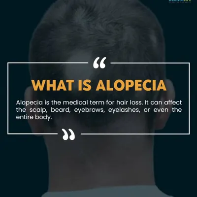September is Alopecia Awareness Month. This post defines Alopecia, which is the medical term for hair loss and can affect any part of the body.