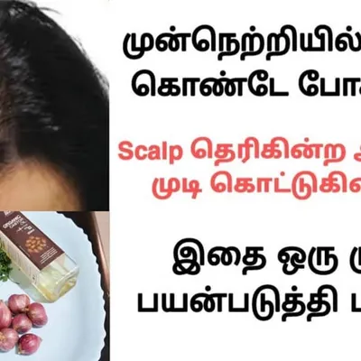 This remedy is for those experiencing hair loss and a visible scalp. I show how to use natural ingredients like onion and herbs to address this.