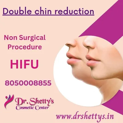 This graphic highlights our non-surgical double chin reduction using HIFU (High-Intensity Focused Ultrasound). This advanced treatment tightens the skin and reduces fat under the chin without any incisions or recovery time.