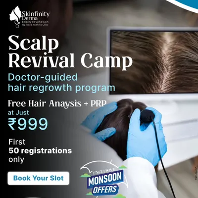 Take advantage of our Monsoon Offer with the Scalp Revival Camp. This doctor-guided program includes a free hair analysis and a PRP session at a special price for the first 50 registrations.