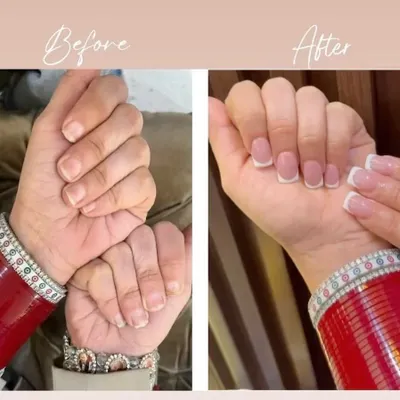 A classic transformation. This before and after shot shows how we create a clean and elegant look with classic French tip nail extensions on short, square-shaped nails.